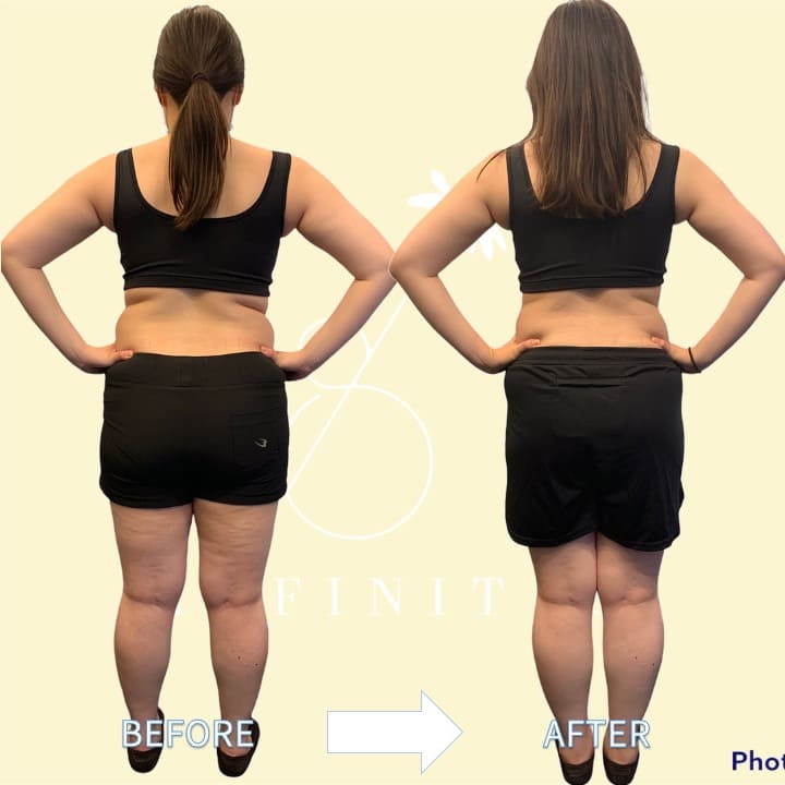 ビフォーアフター